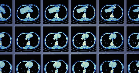 Image showing Many computed tomography scans in motion of lower and middle abdominal area