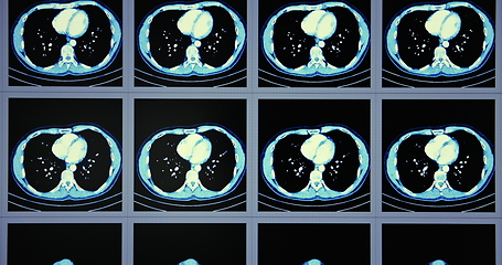 Image showing Many computed tomography scans in motion of lower and middle abdominal area