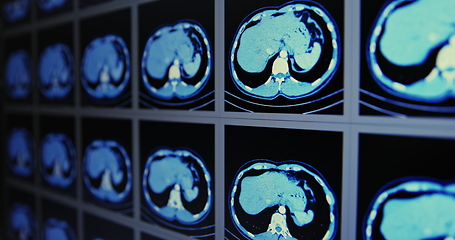 Image showing Many computed tomography scans in motion of lower and middle abdominal area