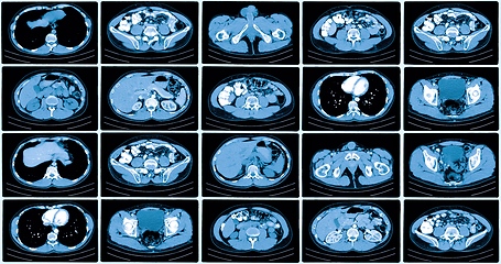 Image showing Many computer tomography scans in motion of lower and middle abdominal area