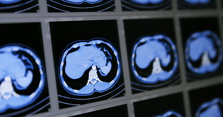 Image showing Many computed tomography scans in motion of lower and middle abdominal area