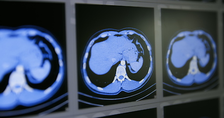 Image showing CT scans as background texture closeup photo