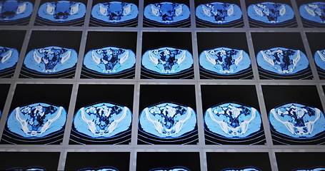 Image showing CT scans as background texture closeup photo