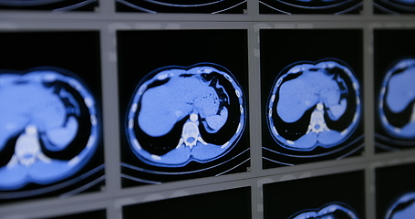 Image showing CT scans as background texture closeup photo