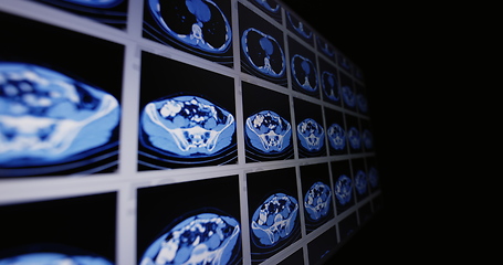 Image showing CT scans as background texture closeup photo