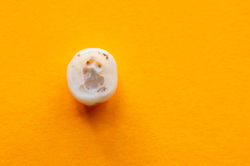 Image showing Human tooth root affected by caries, close-up on yellow background