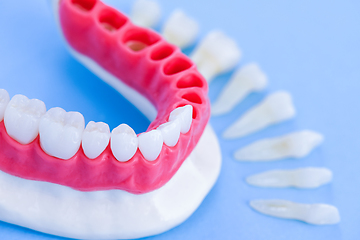 Image showing Tooth implant and crown installation process