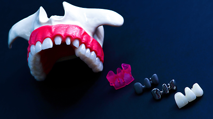 Image showing Tooth implant and crown installation process