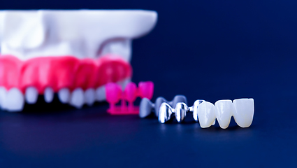 Image showing Tooth implant and crown installation process