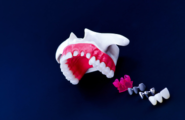 Image showing Tooth implant and crown installation process