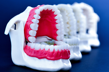 Image showing Dentist orthodontic teeth models