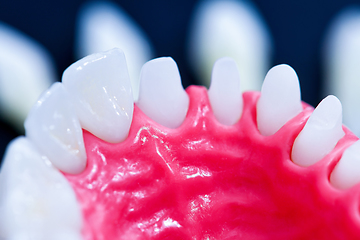 Image showing Tooth implant and crown installation process