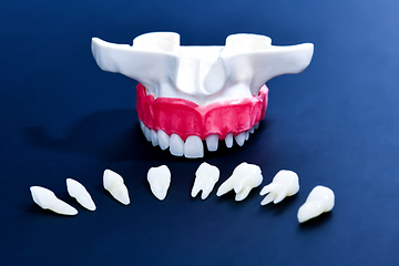 Image showing Tooth implant and crown installation process