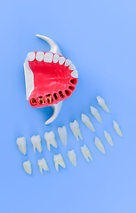 Image showing Tooth implant and crown installation process