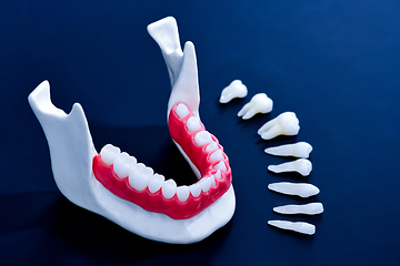 Image showing Tooth implant and crown installation process