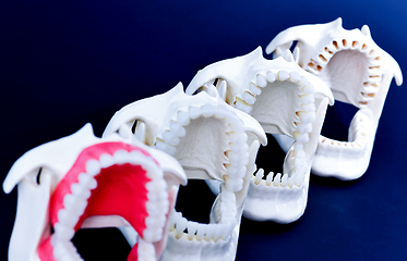 Image showing Dentist orthodontic teeth models