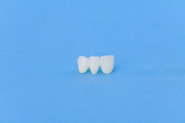 Image showing Metal free ceramic dental crowns