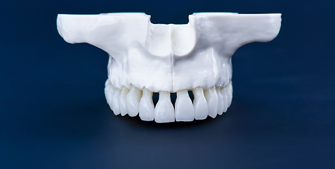 Image showing Upper human jaw with teeth