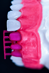 Image showing Tooth implant and crown installation process