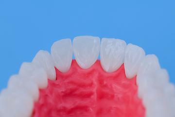 Image showing Upper human jaw with teeth and gums anatomy model