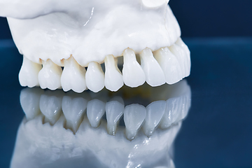 Image showing Upper human jaw model with a reflection on the glass