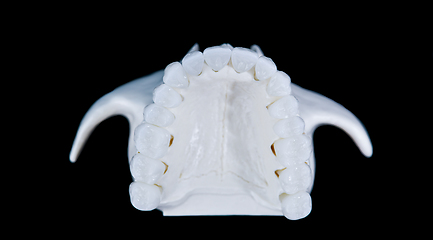 Image showing Upper human jaw with teeth isolated on black background