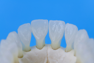 Image showing Lower human jaw with teeth anatomy model