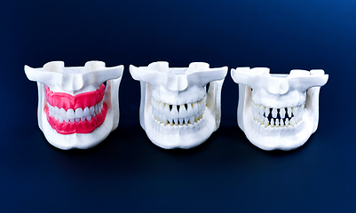 Image showing Human jaws with teeth and gums anatomy models