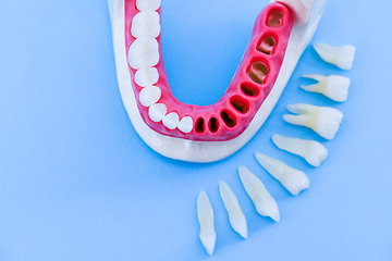 Image showing Tooth implant and crown installation process