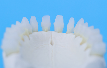 Image showing Lower human jaw with teeth anatomy model