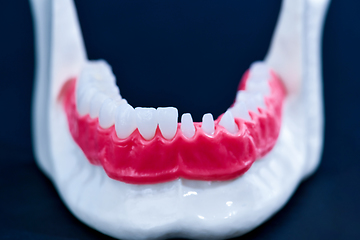 Image showing Tooth implant and crown installation process