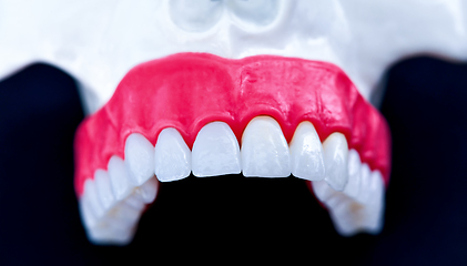 Image showing Upper human jaw with teeth and gums anatomy model