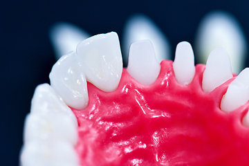 Image showing Tooth implant and crown installation process