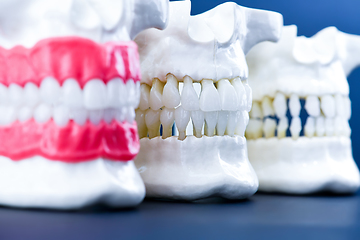 Image showing Human jaws with teeth and gums anatomy models