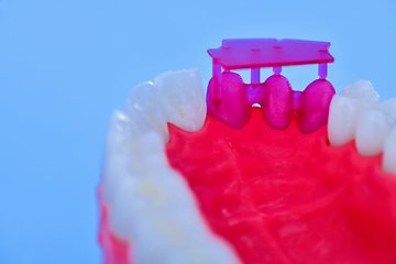 Image showing Tooth implant and crown installation process