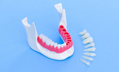 Image showing Tooth implant and crown installation process