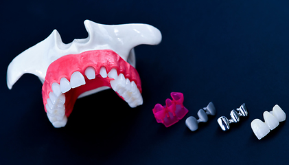 Image showing Tooth implant and crown installation process