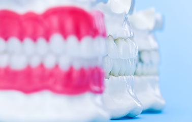 Image showing Human jaws with teeth and gums anatomy models