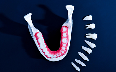 Image showing Tooth implant and crown installation process