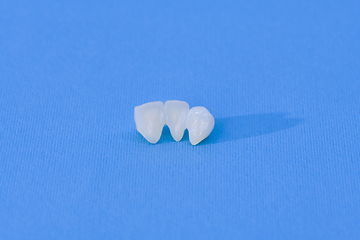 Image showing Metal free ceramic dental crowns