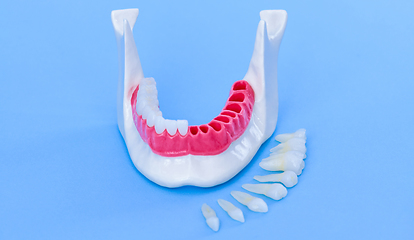 Image showing Tooth implant and crown installation process