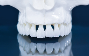 Image showing Upper human jaw model with a reflection on the glass