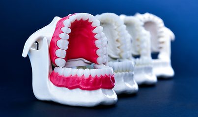 Image showing Dentist orthodontic teeth models