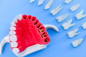 Image showing Tooth implant and crown installation process