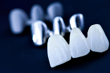 Image showing different types of dental tooth crowns