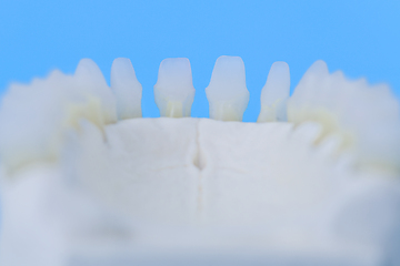 Image showing Lower human jaw with teeth anatomy model