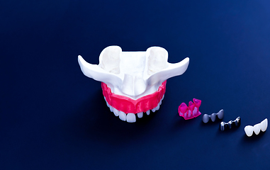 Image showing Tooth implant and crown installation process