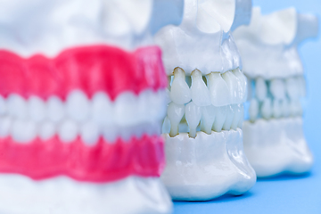 Image showing Human jaws with teeth and gums anatomy models