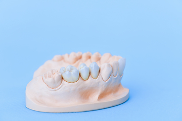 Image showing Gypsum model of human jaw