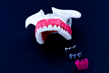 Image showing Tooth implant and crown installation process